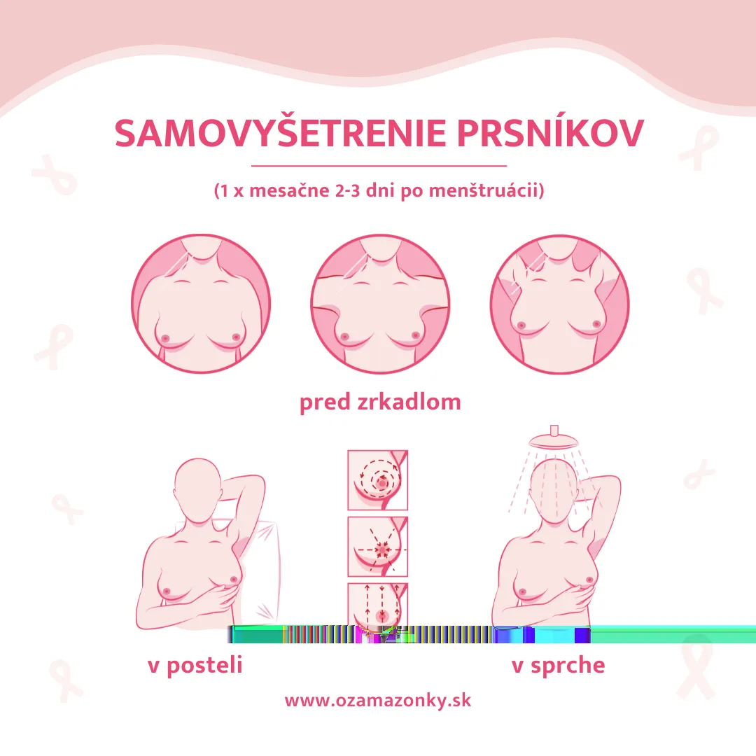Ružový október: BC Prievidza sa spája s Amazonkami 7 samovys etrenie120251018124030